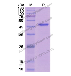 重組ERN1蛋白,Recombinant Human ERN1, N-His