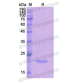 重组PGLYRP1蛋白,Recombinant Human PGLYRP1, N-His