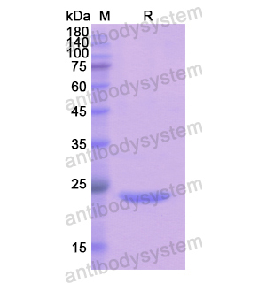 重组PRDM1蛋白,Recombinant Human PRDM1, N-His