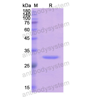 重組FCN3蛋白,Recombinant Human FCN3, N-His