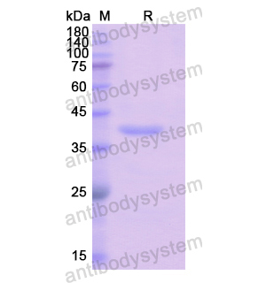 重組ADAP1蛋白,Recombinant Human ADAP1, N-His