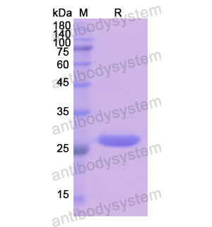 重组NUP155蛋白,Recombinant Human NUP155, N-His