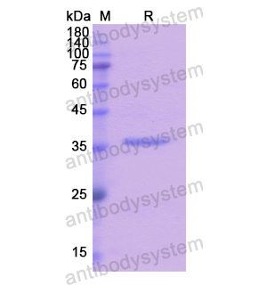 重组TRPA1蛋白,Recombinant Human TRPA1, N-His