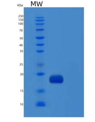 Recombinant Human IL1F10 / IL-38 Protein (His tag),Recombinant Human IL1F10 / IL-38 Protein (His tag)
