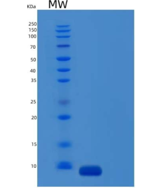 Recombinant Mouse Complement Component C5Protein,Recombinant Mouse Complement Component C5Protein