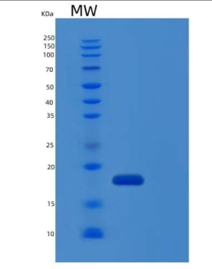 Recombinant Human IL-1RA / IL1RN Protein,Recombinant Human IL-1RA / IL1RN Protein