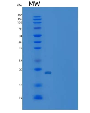 Recombinant Human IL36G / IL1F9 Protein (aa 18-169, His tag),Recombinant Human IL36G / IL1F9 Protein (aa 18-169, His tag)