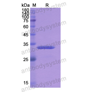 重组CBR3蛋白,Recombinant Human CBR3, N-His