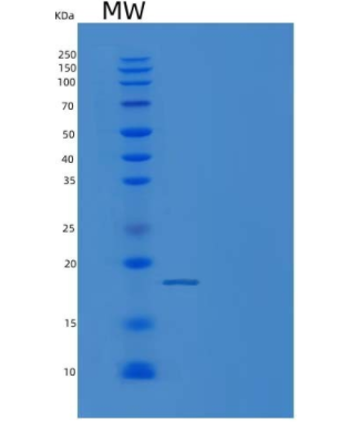 Recombinant Mouse bFGF / FGF2 Protein (His Tag),Recombinant Mouse bFGF / FGF2 Protein (His Tag)