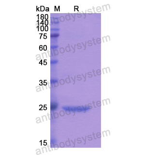 重組CNMD蛋白,Recombinant Human CNMD, N-His