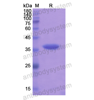 重組MMP23B蛋白,Recombinant Human MMP23B, N-His