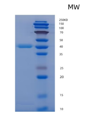 Recombinant Human/Mouse/Rat BMP-2 Protein,Recombinant Human/Mouse/Rat BMP-2 Protein