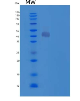 Recombinant Mouse Cathepsin D Protein,Recombinant Mouse Cathepsin D Protein