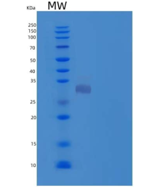 Recombinant Human Chloride Intracellular Channel Protein 2/CLIC2 Protein(N-6His),Recombinant Human Chloride Intracellular Channel Protein 2/CLIC2 Protein(N-6His)