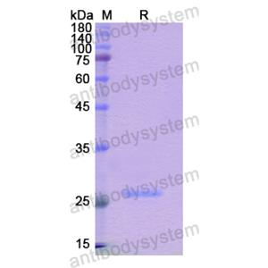 Recombinant Human NOS1AP, N-His