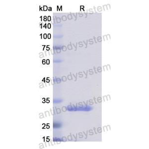 Recombinant Human AOC2, N-His