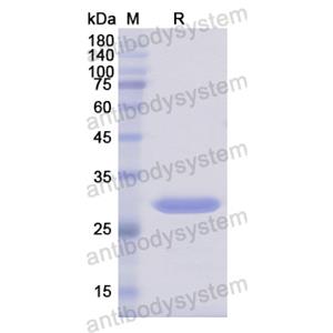 重組HIP1R蛋白,Recombinant Human HIP1R, N-His