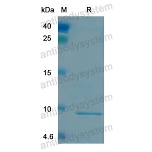 Recombinant Human LRP5, N-His