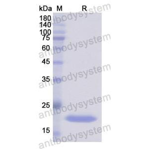 重組GADD45B蛋白,Recombinant Human GADD45B, N-His