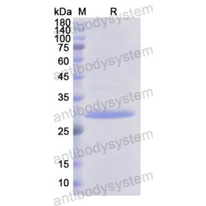 Recombinant Human CDH16, N-His