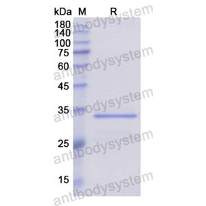 Recombinant Human FLNB, N-His