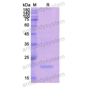 Recombinant Human KATNA1, N-His