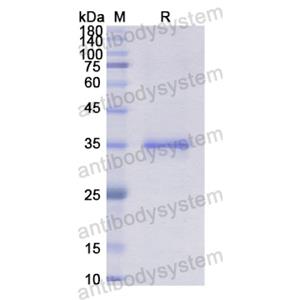 Recombinant Human NR1I2, N-His