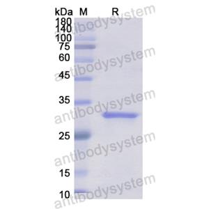 Recombinant Human GPC4, N-His