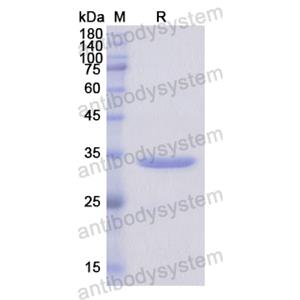 Recombinant Human SF3B1, N-His