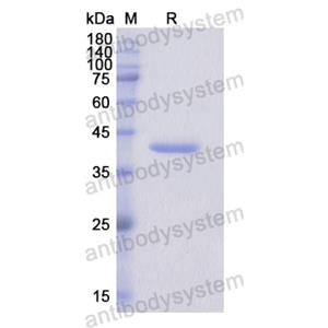 Recombinant Human RPS6KA5, N-His