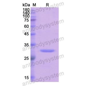 Recombinant Human FCN3, N-His