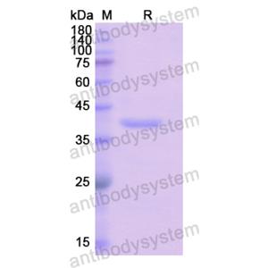 Recombinant Human ADAP1, N-His