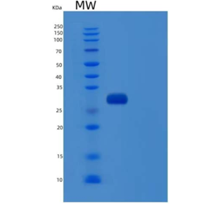 Recombinant Human Ubiquitin Carboxyl-Terminal Hydrolase Isozyme L3/UCH-L3 Protein(C-6His)