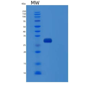 Recombinant Human Serpin A1/alpha-1-Antitrypsin Protein(C-6His)