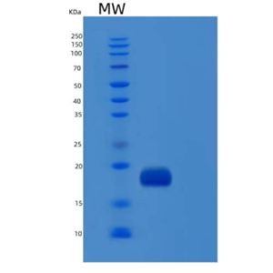 Recombinant Human IL1F10 / IL-38 Protein (His tag)