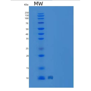 Recombinant Human CCL8 / MCP-2 Protein (His Tag),Recombinant Human CCL8 / MCP-2 Protein (His Tag)
