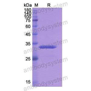 Recombinant Human CBR3, N-His