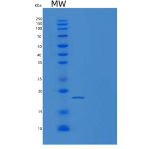 Recombinant Mouse bFGF / FGF2 Protein (His Tag),Recombinant Mouse bFGF / FGF2 Protein (His Tag)