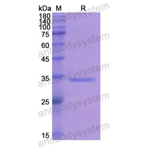 Recombinant Human AP1G2, N-His