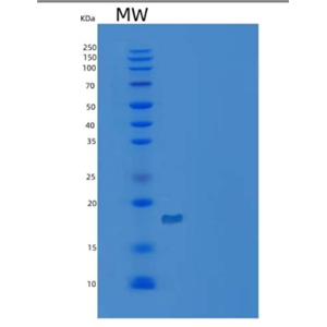 Recombinant Mouse C-X-C motif Chemokine 15/CXCL15/Lungkine Protein(C-6His)