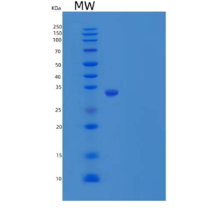 Recombinant Human HDHD2 Protein(N-6His)