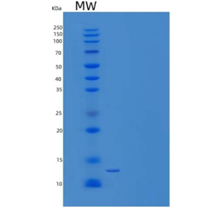 Recombinant Mouse Cystatin 8/CST8 Protein(N-6His)