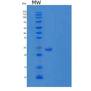 Recombinant Human Synaptobrevin Homolog YKT6/YKT6 Protein(N-6His)