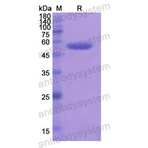 Recombinant Human ALDH1L1, N-His