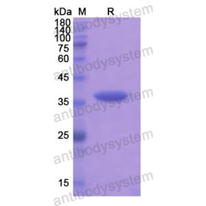 Recombinant Human MMP23B, N-His