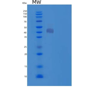 Recombinant Mouse Cathepsin D Protein