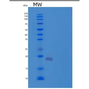 Recombinant Human Hemoglobin Subunit ζ/HBAZ Protein(N-6His)