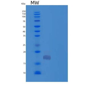Recombinant Human Thioredoxin Domain-Containing Protein 12/TXNDC12/ERp18 Protein(C-6His)