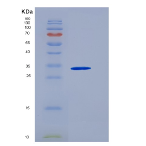 Recombinant Human Thioredoxin Domain-Containing Protein 15/TXNDC15 Protein(C-6His)