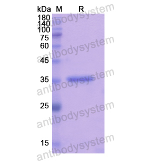 重組RGS9蛋白,Recombinant Human RGS9, N-His